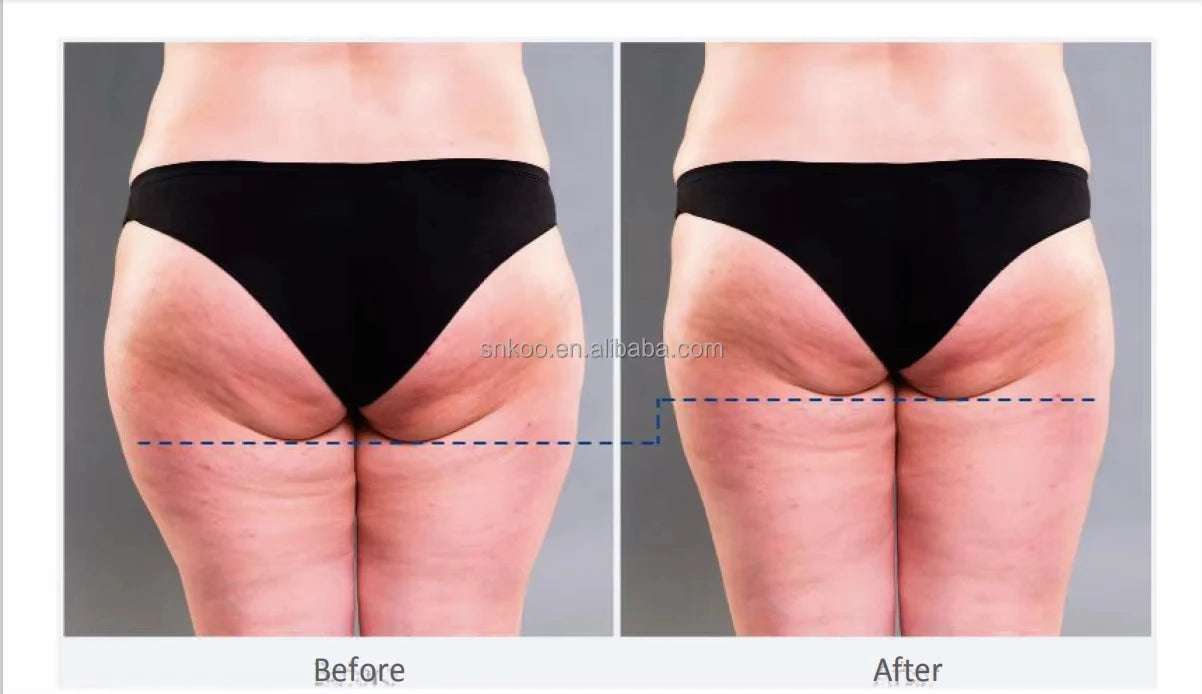 Emsnova Muscle Shaping And Slimming Trainer 6500W EMS Device For Buttocks Lifting Home Gym