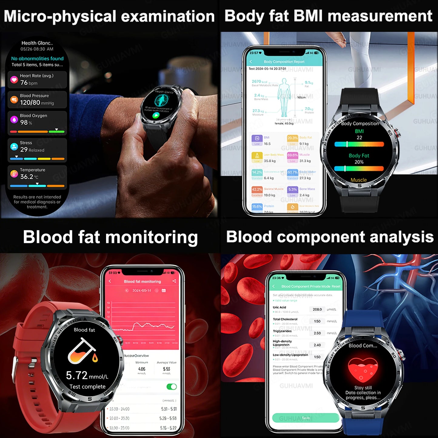 Smart Health Watch With ECG And PPG Body Fat Analysis Uric Acid BP Blood Oxygen Bluetooth Calling