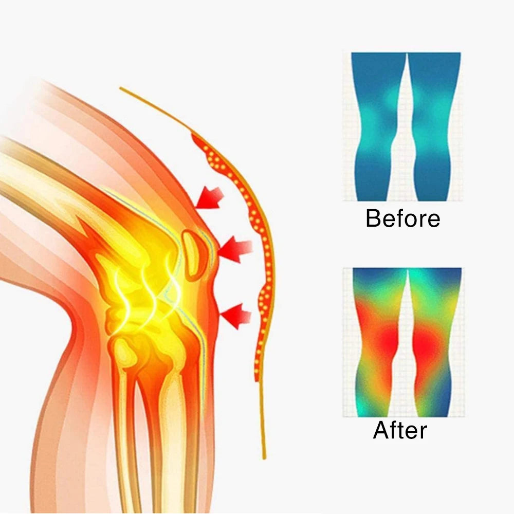 Hailicare Tourmaline Magnetic Therapy SelfHeating Knee Pads